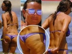 paola perego cellulite